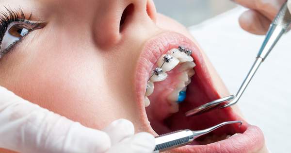 11 razones para tener un tratamiento de ortodoncia