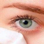 3 Causas y tratamientos para la alergia ocular