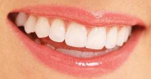 3 causas que pueden ocasionar la separacion de los dientes