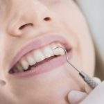 4 elementos que debes conocer si tienes un diente fisurado