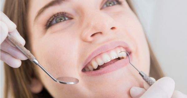 5 Aspectos que se incluyen dentro de un seguro dental