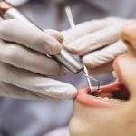 5 causas que provocan abscesos en la boca