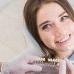 5 ventajas de utilizar carillas dentales