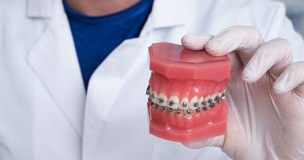 6 consecuencias del uso de brackets dentales