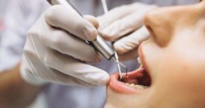 6 efectos secundarios de la limpieza dental profunda