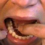6 pasos para utilizar correctamente hilo dental en las muelas
