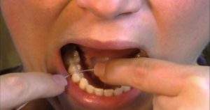 6 pasos para utilizar correctamente hilo dental en las muelas