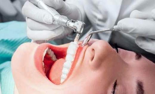 7 beneficios de la limpieza dental ultrasónica
