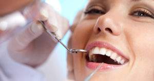 8 preguntas frecuentes sobre la limpieza dental