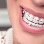 ¿A qué se debe el movimiento de los dientes?
