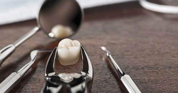 Alternativas a la extracción de dientes