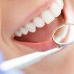 Aprende cómo protegerte de la erosión dental