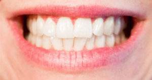 Atención tener dientes blancos no significan que estén sanos