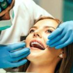 Bandas elásticas en los tratamientos de ortodoncia