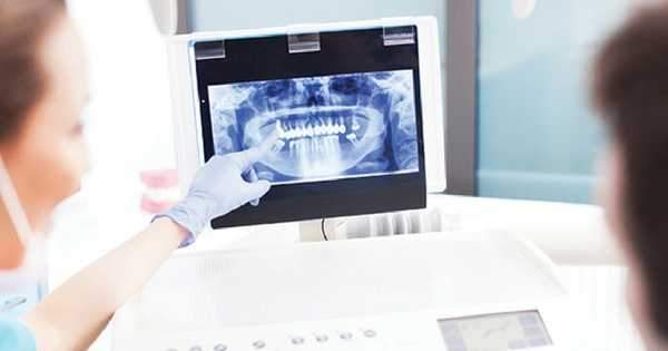 Conoce la Importancia de las Radiografías dentales