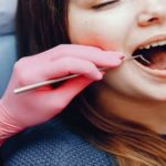 Conoce los 5 incidentes dentales que requieren cura de emergencia