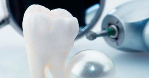 Conoce los cuidados antes y después de una extracción dental (exodoncia)