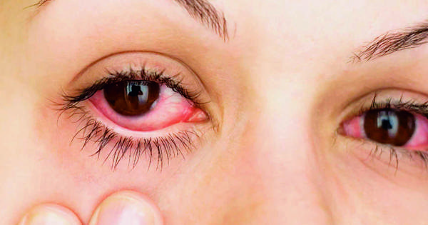 Consejos para evitar la alergia ocular