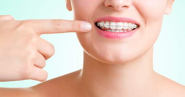 Diferencias entre la ortodoncia removible y la fija