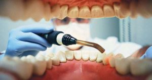 El miedo al dentista complica el trabajo dental