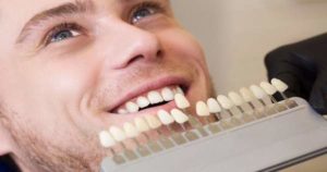 Estos son los principales tratamientos de estética dental