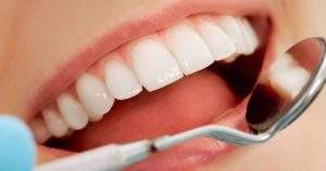 La importancia de mantener tus dientes blancos