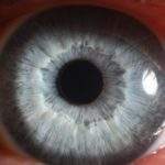 La retina ocular puede mostrar enfermedades cerebrales