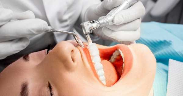 Limpiezas dentales ultrasónicas o manuales ¿Cuál es mejor