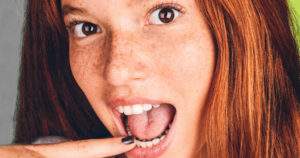 Lo que debes saber sobre la ortodoncia lingual