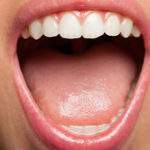 Los 10 síntomas dentales más comunes