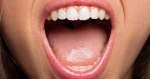 Los 10 síntomas dentales más comunes