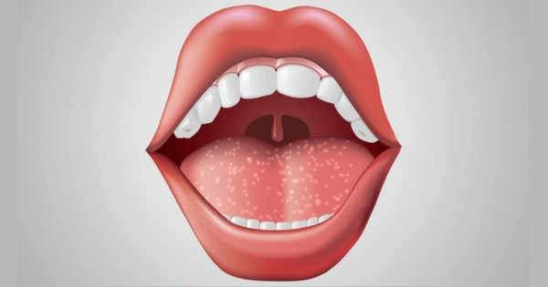 Más allá de los dientes ¿Qué hay en tu boca