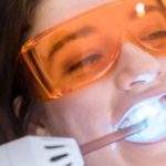 Métodos de blanqueamiento dental efectivos