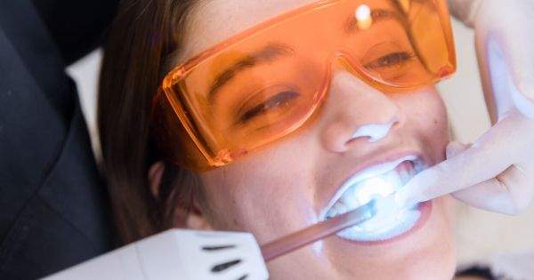 Métodos de blanqueamiento dental efectivos