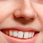 Separación entre dientes: causas y tratamiento