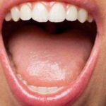 Síntomas, causas y soluciones a la lengua inflamada