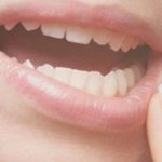 Soluciones para reparar un diente astillado