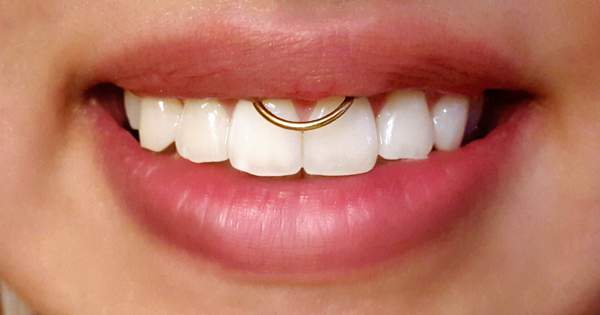 ¿Son perjudiciales los piercings orales?