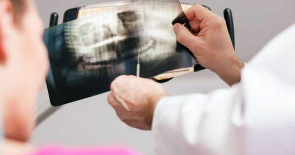 Terapia endodóntica y el éxito de las radiografías dentales