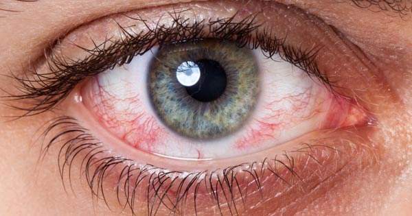 Todo lo que debes saber sobre los lentes intraoculares