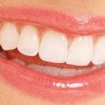 3 causas que pueden ocasionar la separación de los dientes