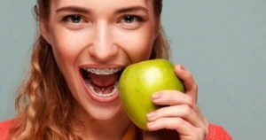 6 consejos de alimentación para pacientes con ortodoncia