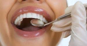 8 secretos para proteger tus dientes contra las caries