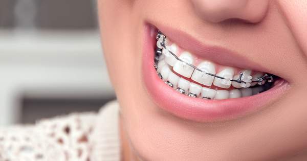 ¿A qué se debe el movimiento de los dientes?
