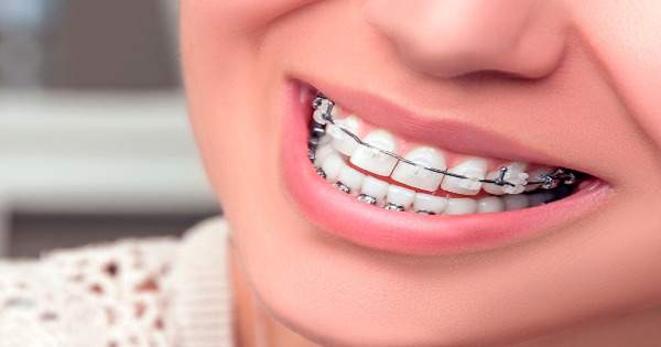 Algunas razones por las que debes hacerte ortodoncia
