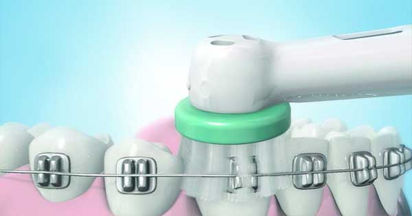 Cepillado Dental Correcto