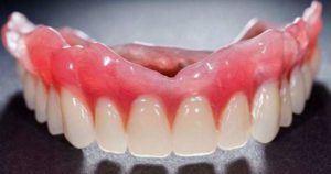 Cómo funciona el adhesivo para dentaduras postizas