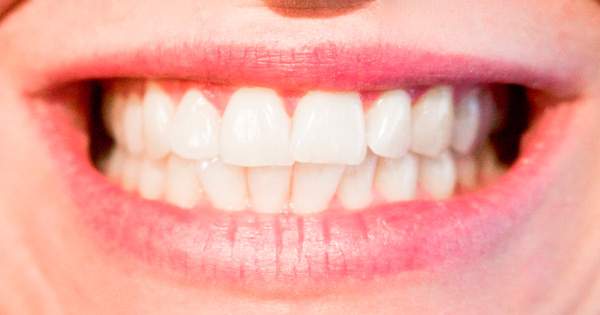 Consejos para elegir la ortodoncia que te conviene