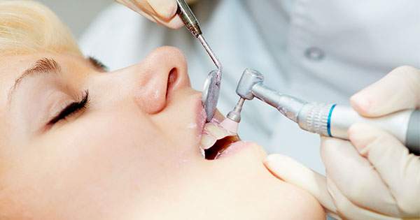 Descubre cómo saber si necesitas una profilaxis dental