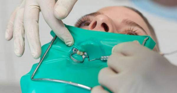Dique de hule en el consultorio dental ¿Qué es y cuál es su función